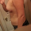 2 days post op 510cc in each breast