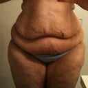 This is me after losing 135 pounds...I was 332 pounds 5 years ago....it's TIME for a serious TUMMY TUCK!!