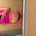 9 days post op