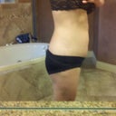 12 week post op