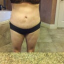 12 week post op