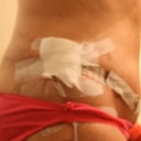 8 days after surgery