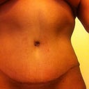 6 weeks PO