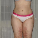 6 weeks