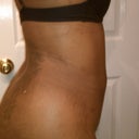 August 9th - 15 days POST