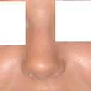 My nose from the front, before any surgery.
