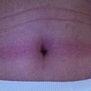 marks are from my binder that i will wear for another 2 weeks