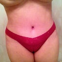 4 weeks post op