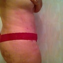 Right side 4 weeks  I still have a little bruising :/