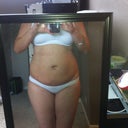 1 week post op