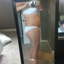 1 week post op