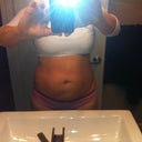 1.5 months post op