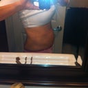 1.5 months post op