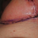 Much of the redness is from a rash - allergic reaction