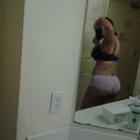 5 days post op