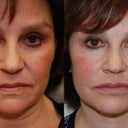 before/after eric joseph