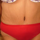 3 months post surgery - 173 lbs - 2 pant sizes smaller