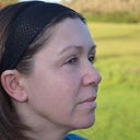 One month post treatment, no make up