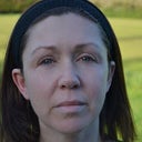 One month post treatment, no make up.