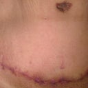 Me before removal of dog ears. This is me bending down.