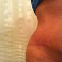 Right hip no dent.