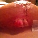 it just keeps getting bigger