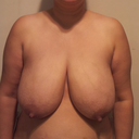 Before Front