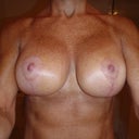 Post op week 7