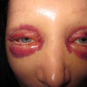 upper and lower eyes