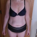 The pics are the taken the day before surgery
