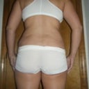 3 weeks post op