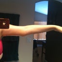 Right arm 1 week post op