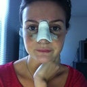 Post Op - Day 7 (day of cast removal)