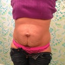 My destroyed belly