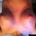 3 weeks post