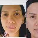 Before & After 1