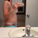 13 days post op