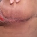 Left Breast 1/13/2013