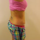 3 weeks post-op