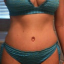 4 months post op