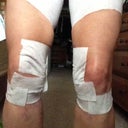 Day of revision surgery