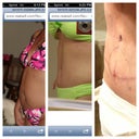 Beg  6 mos and now 1/12/13