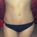 3 wks po