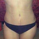3 weeks po