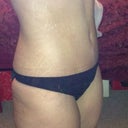 3 wks po