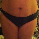 Pre op front