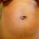 Not sucking in and 2 hernia's