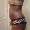 Preop