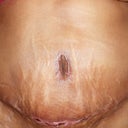 23 days front view