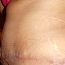 23 days left side view